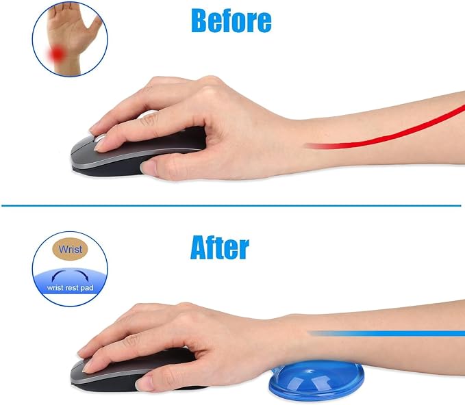 Gel Keyboard & Mouse Wrist Rest Set - Keyboard Wrist Rest Pad & Mouse Support for Office Gaming Pad Computer Laptop Ergonomic Comfortable Pain Relief- Pad Set (Mouse Support Set)
