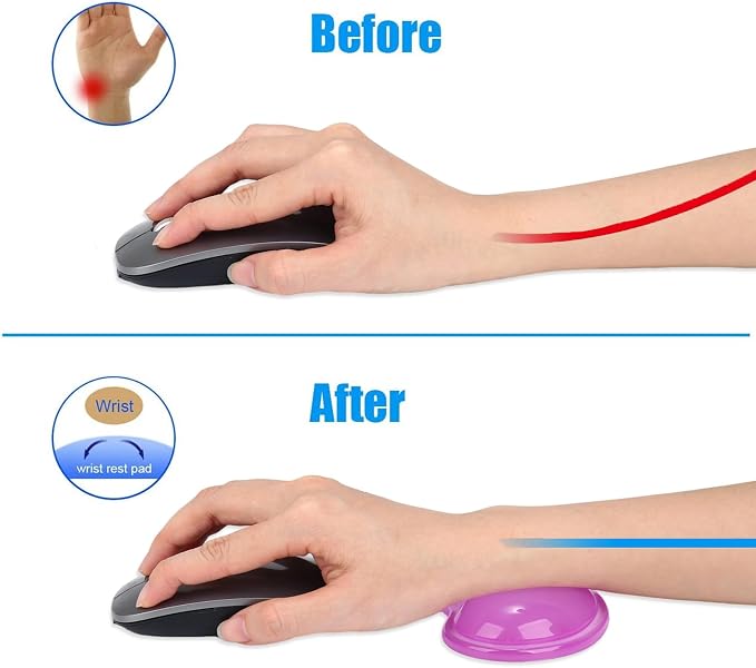 Gel Keyboard & Mouse Wrist Rest Set - Keyboard Wrist Rest Pad & Mouse Support for Office Gaming Pad Computer Laptop Ergonomic Comfortable Pain Relief- Pad Set (Mouse Support Only)