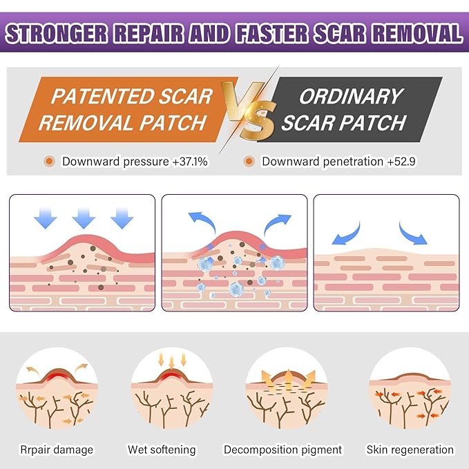 Silicone Scar Sheets,Silicone Scar Tape,Silicone Scar Removal Strips for Surgical,C-Section,Tummy Tuck,Keloid Scars (1.6"X 157" Roll-4M) Keloid Bump Removal