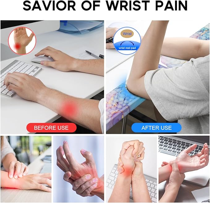 JIKIOU L-Shaped Desk Elbow Pad for Desk 2 Pack, Soft Memory Foam Elbow Support Padding with Non-Slip Base, Easy Typing Pain Relief Comfort for Office Work Gaming Marble Blue