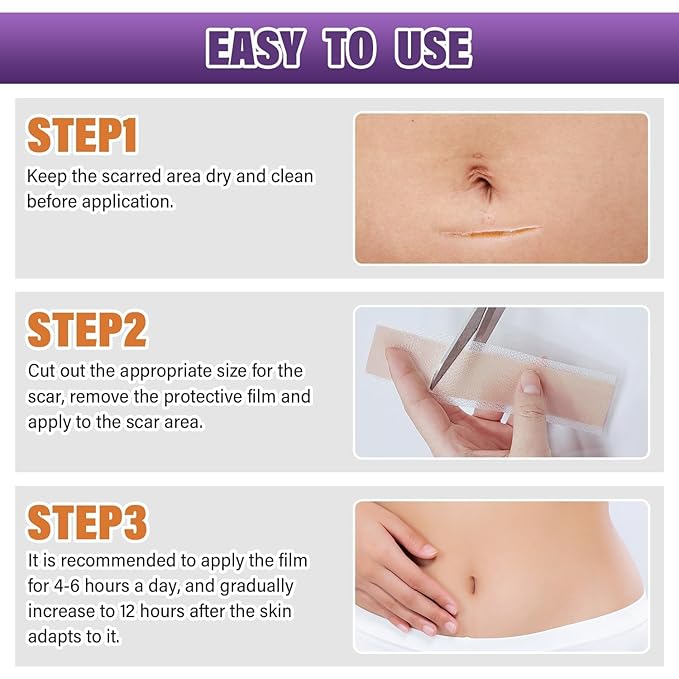 Silicone Scar Sheets,Silicone Scar Tape,Silicone Scar Removal Strips for Surgical,C-Section,Tummy Tuck,Keloid Scars (1.6"X 120" Roll-3M) Keloid Bump Removal