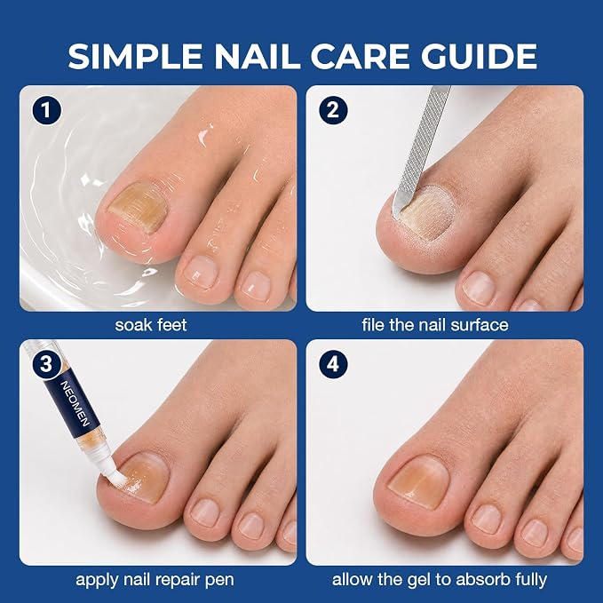 Nail Fungus Pen, Toenail Fungus Pen Treatment for Toenails & Fingernails, Daily Nail Appearance Care - 4 Count