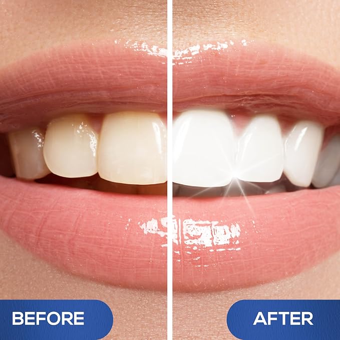 Venus Visage Teeth Whitening Pen and Tooth Polishing Kit (Pack of 4) – Professional Teeth Whitening Gel, 30+ Uses, Low Sensitivity, Enamel-Safe Mint Formula – Removes Coffee, Wine & Tobacco Stains