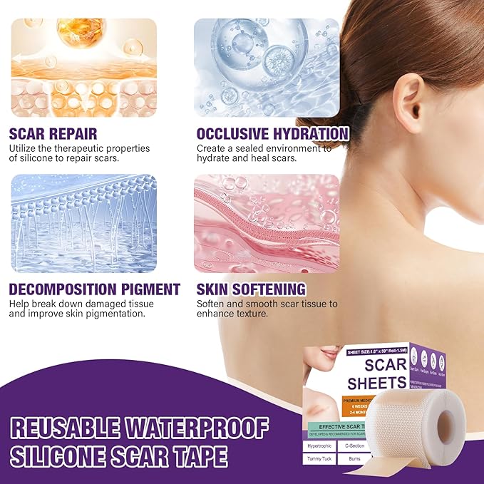Silicone Scar Sheets,Silicone Scar Tape,Silicone Scar Removal Strips for Surgical,C-Section,Tummy Tuck,Keloid Scars (1.6"X 120" Roll-3M) Keloid Bump Removal