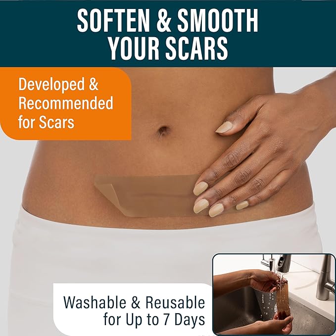 NUVADERMIS Silicone Scar Sheets - Extra Long Scar Sheets for C-Section, Tummy Tuck, Keloid, and Surgical Scars - Reusable Medical Grade Silicone Scar Sheets - Pack of 4 - Light Tone