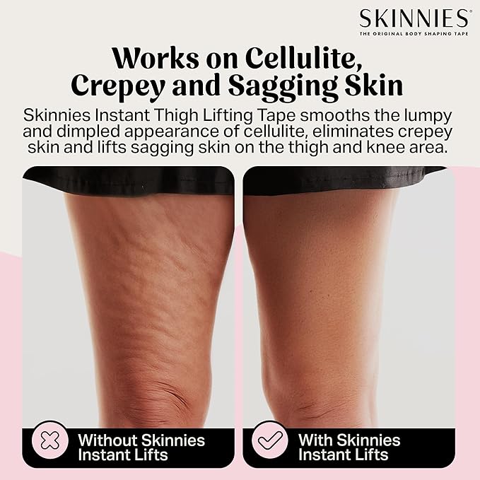 Skinnies Instant Thigh Lift Tape - Patented & Made in USA - Clear Adhesive Strips Instantly Lift Loose Skin and Smooth Cellulite - Sweatproof and All-Day Wear Body Tape for Women - 5 Pairs
